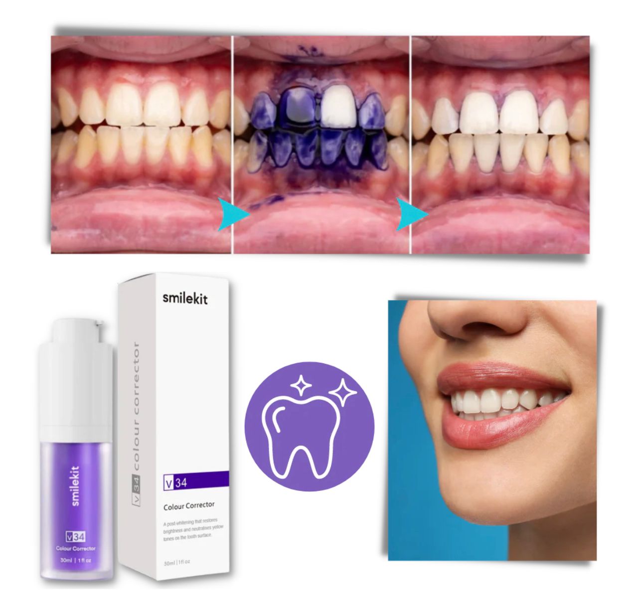 Blanqueador dental purple V34